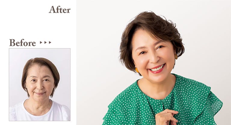 ハーフウィッグ Before/after
