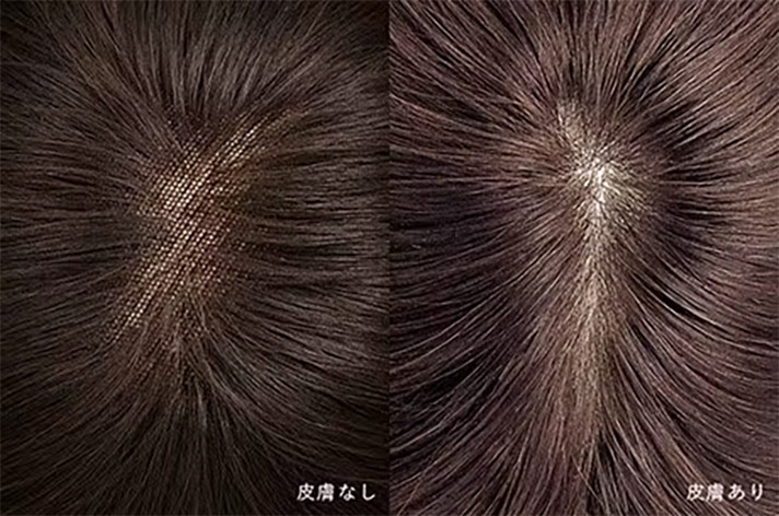 皮膚なし・皮膚あり