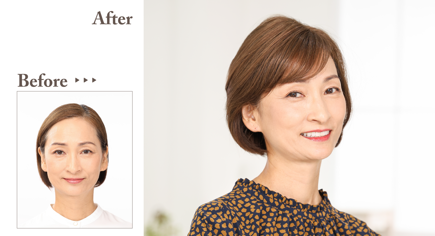 スヴェンソンのヘアピース