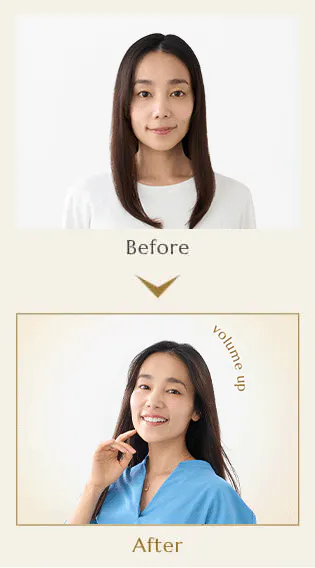 before after