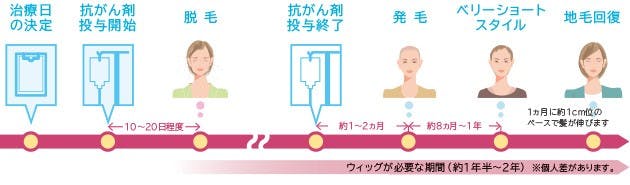 毛量 毛質の変化 抗がん剤治療開始 終了までの経過 化学療法 医療用ウィッグ 女性用かつら カツラ レディススヴェンソン