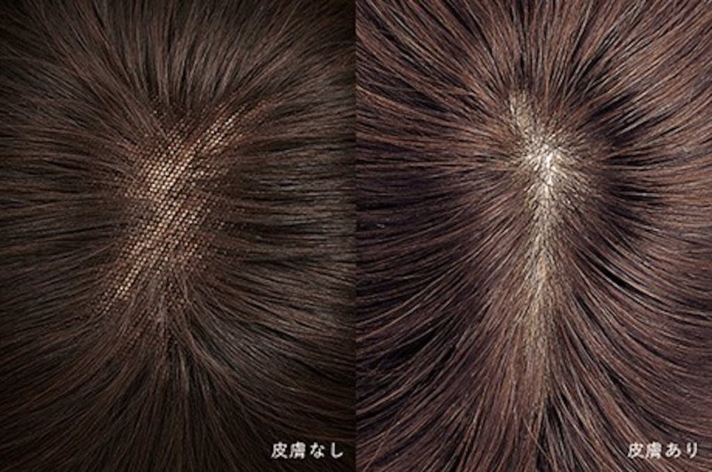 ウィッグ 皮膚ありなし