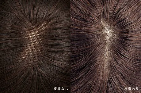 人工皮膚を使用