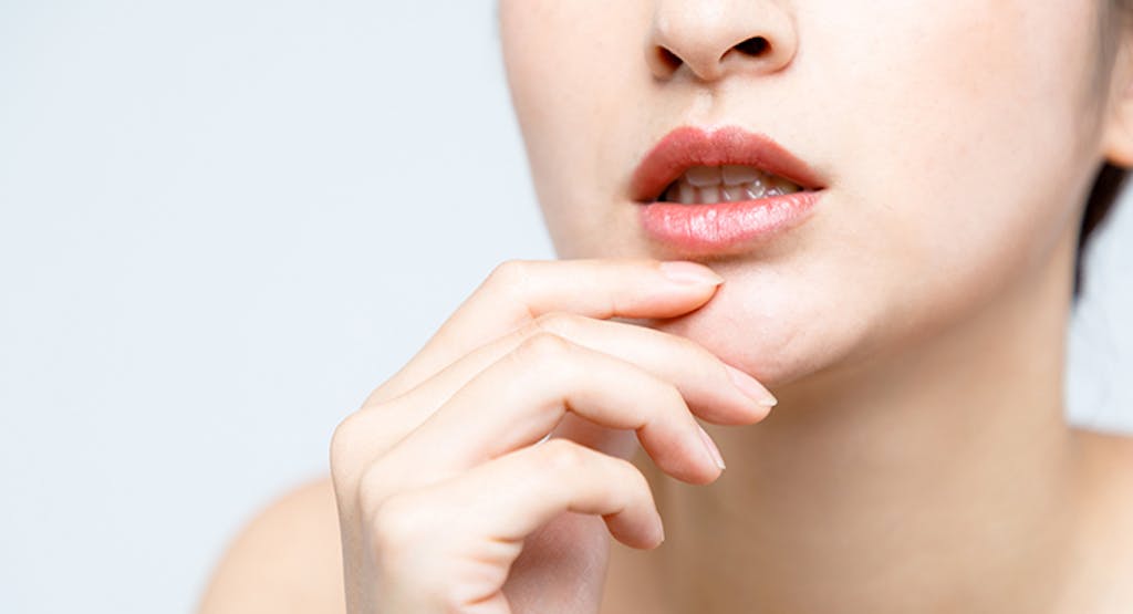 抗がん剤の影響でお口の中に起こること　 口内炎（粘膜炎）ができやすくなる