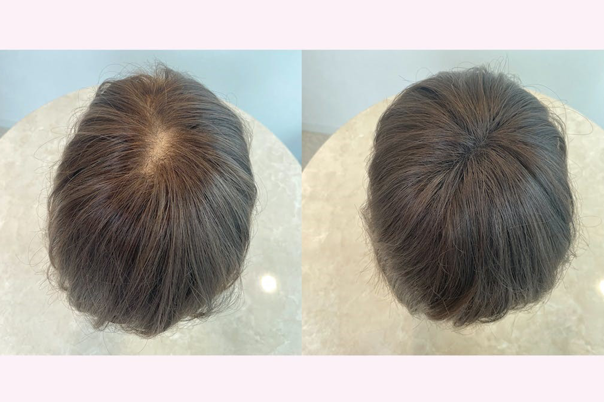 毛材やつむじなどの造りが自然なウィッグを選ぶ