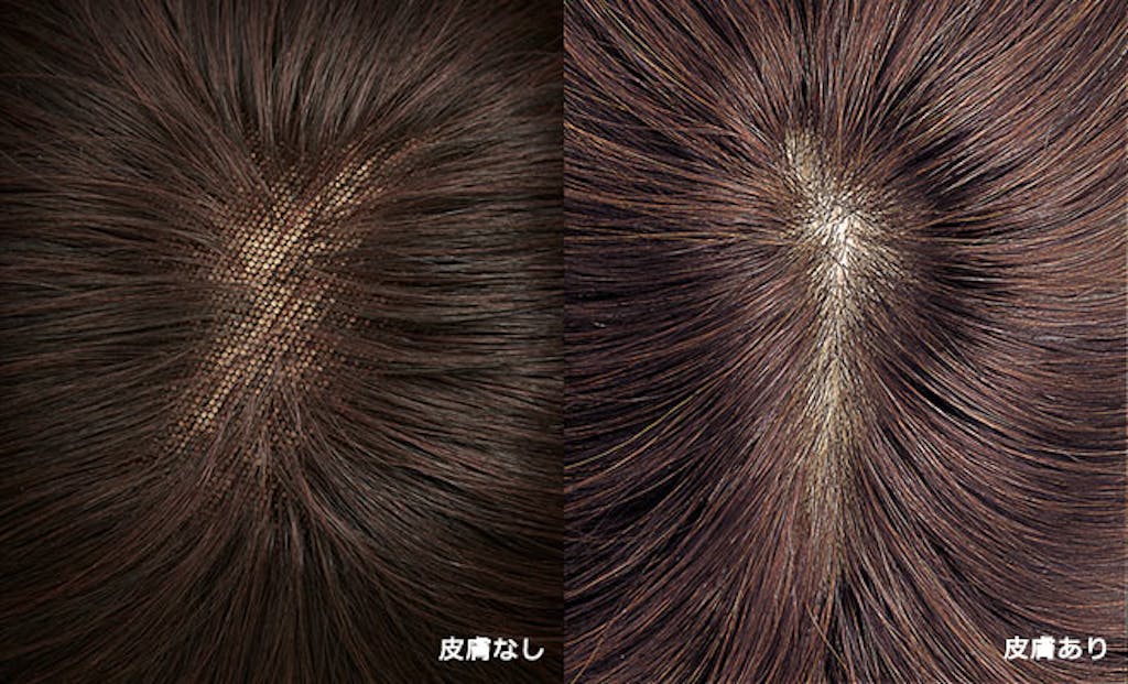 皮膚なし 皮膚あり