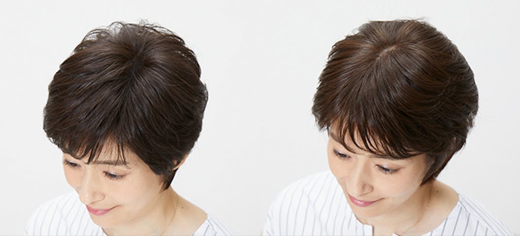 ウィッグのつむじ部分